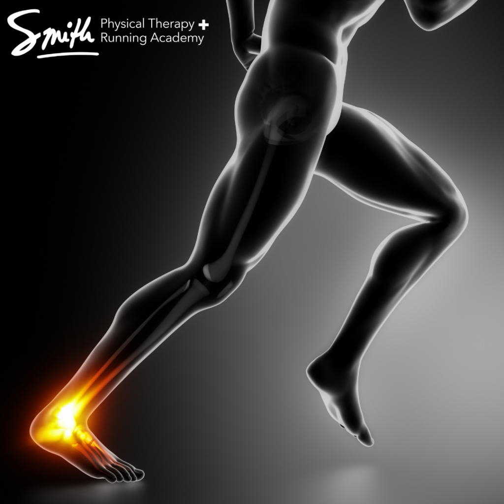 Achilles sprain ankle running