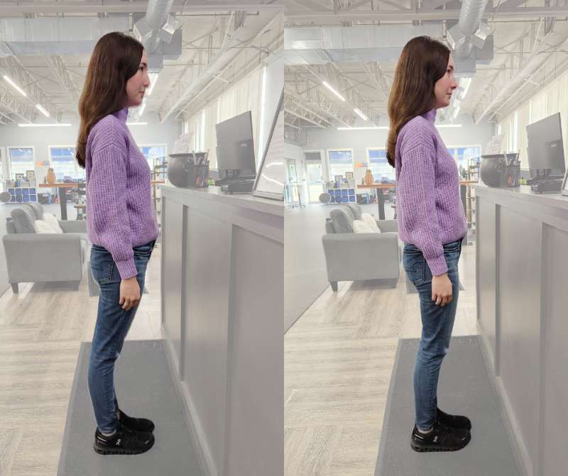 hypermobility side by side